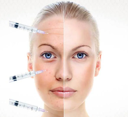  حقن التجميل